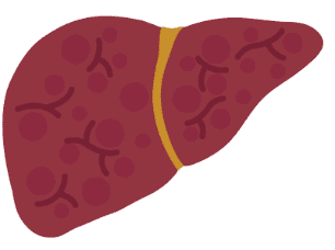 Icon of liver with moderate fibrosis stage F2